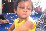 Vụ bé gái 4 tuổi nghi bị cha nuôi bạo hành: Đánh con bằng chổi cán nhựa-3