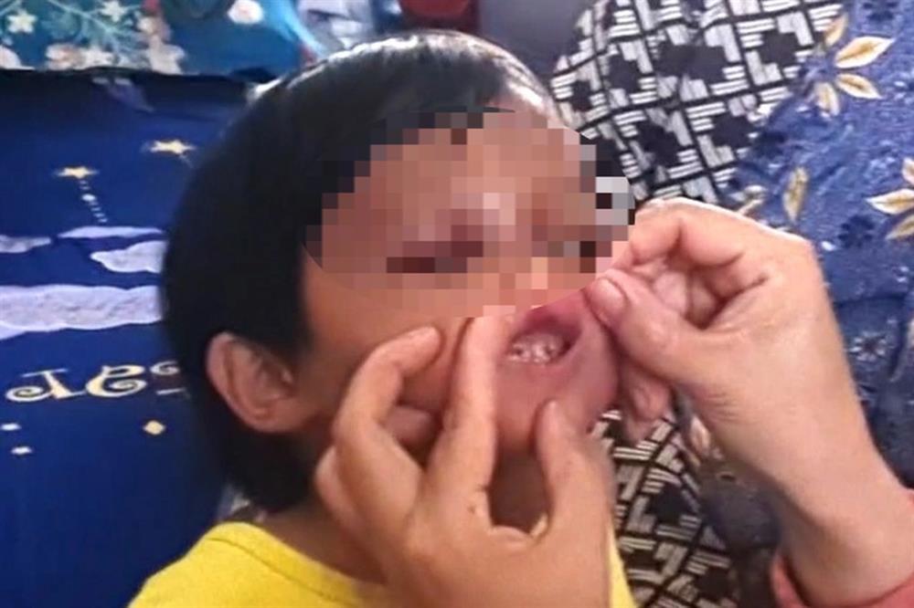 Vụ bé gái 4 tuổi nghi bị cha nuôi bạo hành: Đánh con bằng chổi cán nhựa-1