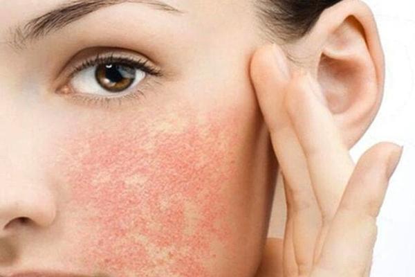 Nồng độ cồn trong mỹ phẩm có tác dụng gì?-3