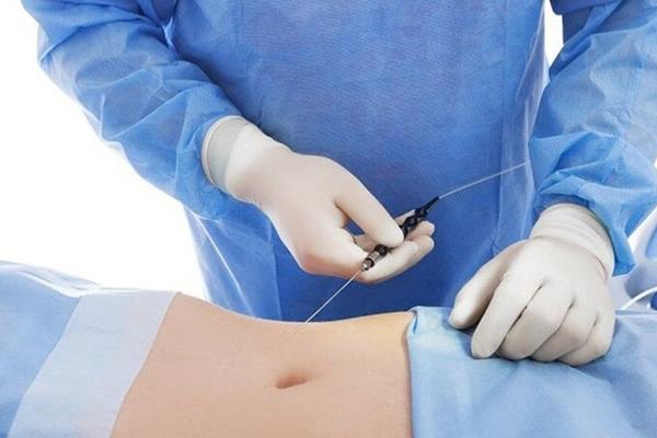 Ngôi sao truyền hình 29 tuổi chết sau phẫu thuật hút mỡ đầu gối-5