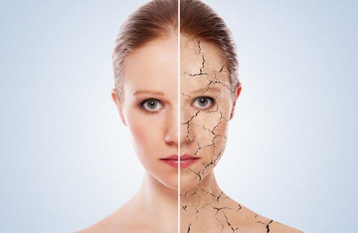 Da khô và da mất nước khác nhau thế nào?-1