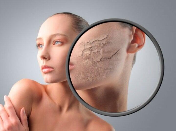 Da khô và da mất nước khác nhau thế nào?-2