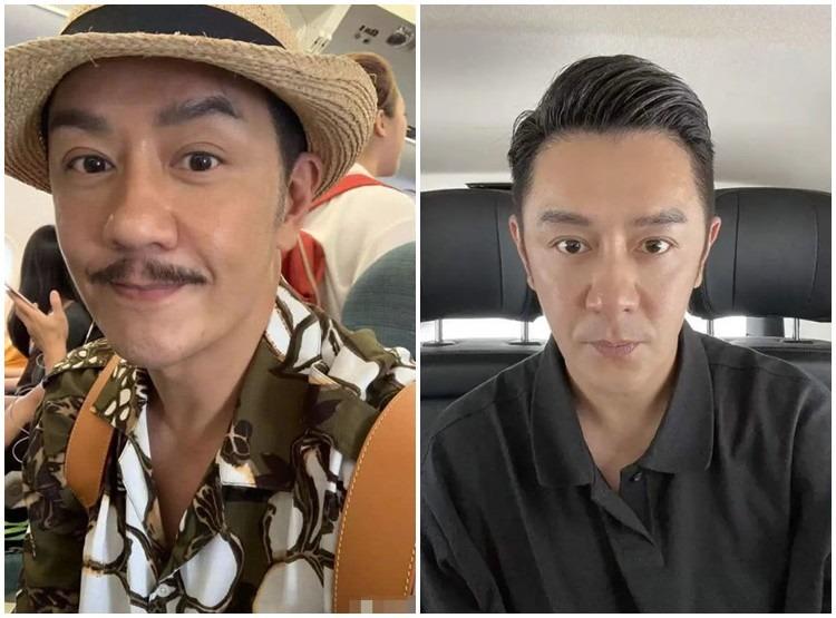 Mỹ nam không tuổi đình đám một thời giờ diện mạo không thể nhận ra vì dao kéo-4