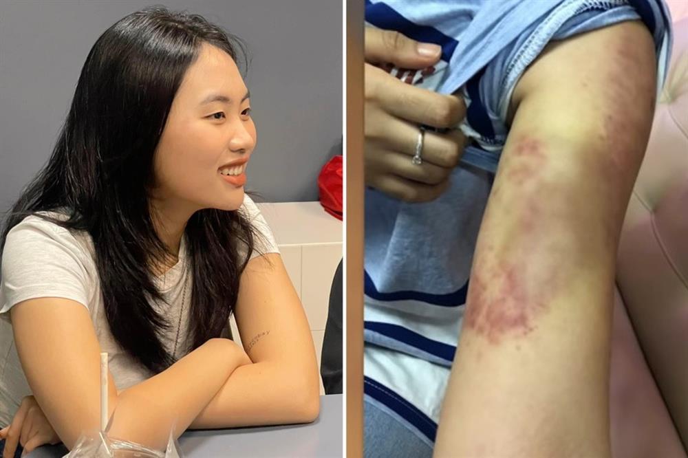 Sao Việt giảm cân sai cách: Phương Mỹ Chi bầm dập, Lan Ngọc nhập viện-5