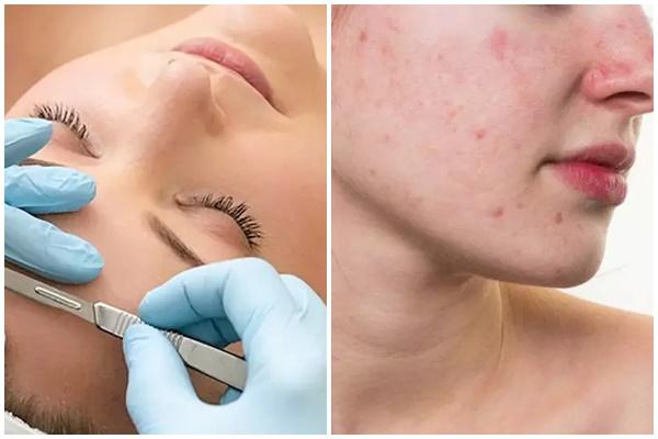 Tác dụng bất ngờ của đinh lăng trong làm đẹp-3