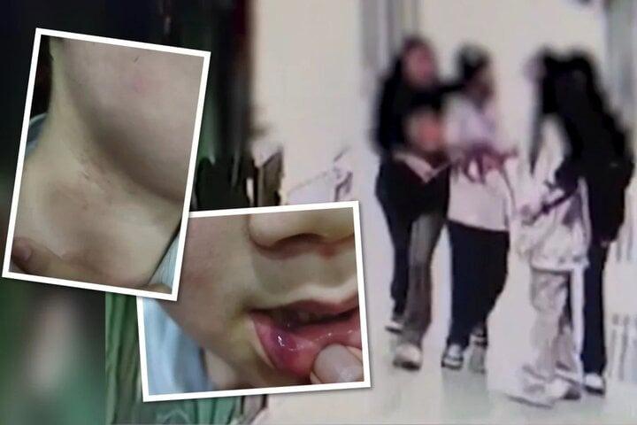 Người cha treo thưởng 34 triệu đồng cho ai tìm được kẻ đánh đập con mình-1