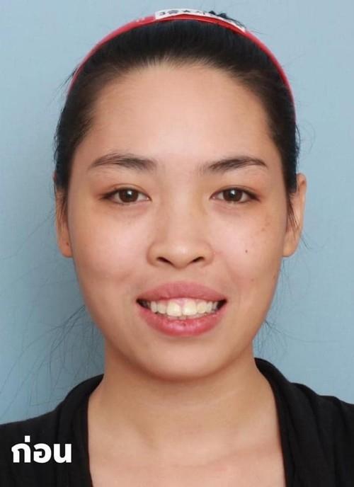 Hot girl thẩm mỹ số 1 Nam Định: Người ta gọi tôi là hàng dao kéo, sinh con không đẹp-1