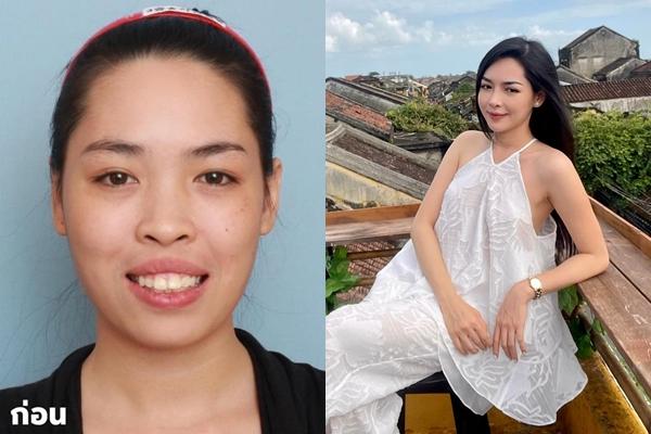 Phẫu thuật thẩm mỹ quá nhiều, cô gái gặp sự cố khi gia hạn giấy phép lái xe-2