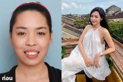 'Hot girl thẩm mỹ số 1 Nam Định': Người ta gọi tôi là 'hàng dao kéo', sinh con không đẹp
