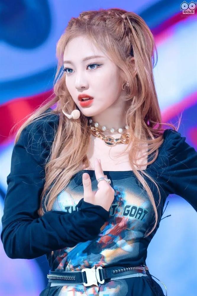 Nữ ca sĩ bị mù một bên mắt tạo cơn sốt-9