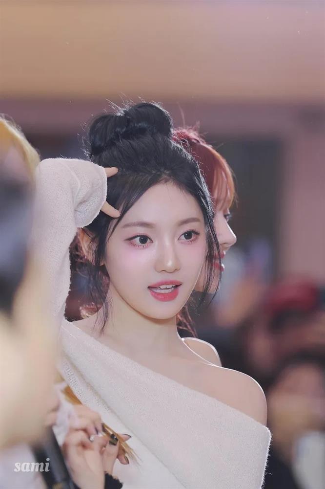 Nữ ca sĩ bị mù một bên mắt tạo cơn sốt-10