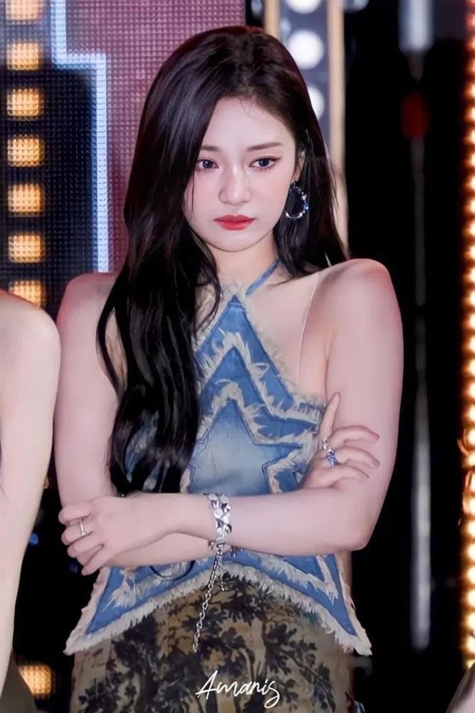 Nữ ca sĩ bị mù một bên mắt tạo cơn sốt-14