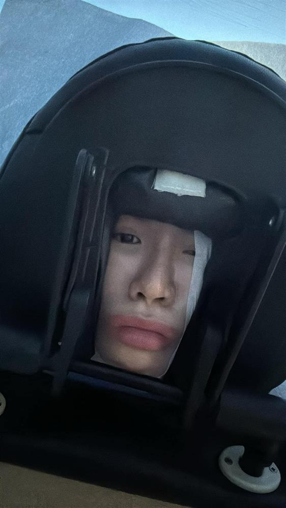 Minh Tú phải hủy show diễn phút chót vì lý do sức khỏe, tiết lộ đang tập vật lý trị liệu khiến fan lo lắng-1