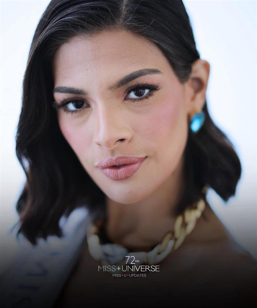 Nhan sắc Hoa hậu Hoàn vũ 2023 trong ngày đầu đương nhiệm bị chê bai-4