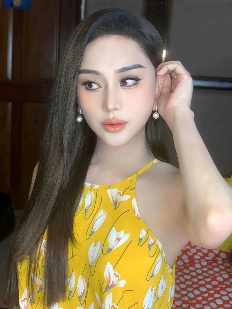 Giá dao kéo của sao Việt: Người chi 1 tỷ làm Phạm Băng Băng, vợ Văn Hậu gây bất ngờ-1