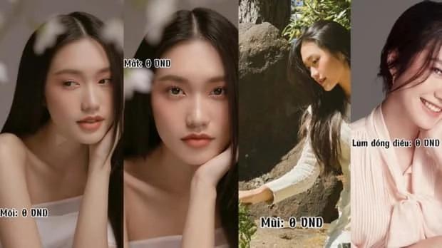 Giá dao kéo của sao Việt: Người chi 1 tỷ làm Phạm Băng Băng, vợ Văn Hậu gây bất ngờ-10