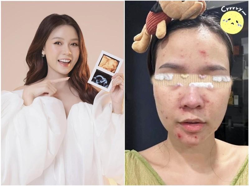 Bị nhắc bầu vượt mặt vẫn mang giày cao gót, Sam vội lên tiếng cầu xin một điều này!-6