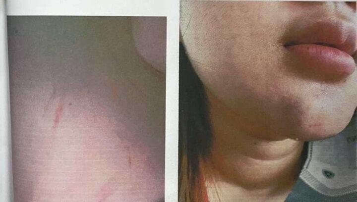 Vụ nữ sinh lớp 12 tố bị phụ huynh đánh hội đồng: Trường THPT Sài Gòn lên tiếng-1