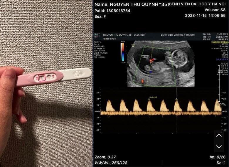 Thu Quỳnh lần đầu bế bầu đi sự kiện sau thông báo mang thai lần 2, nhan sắc rạng rỡ khiến dân tình xuýt xoa!-1