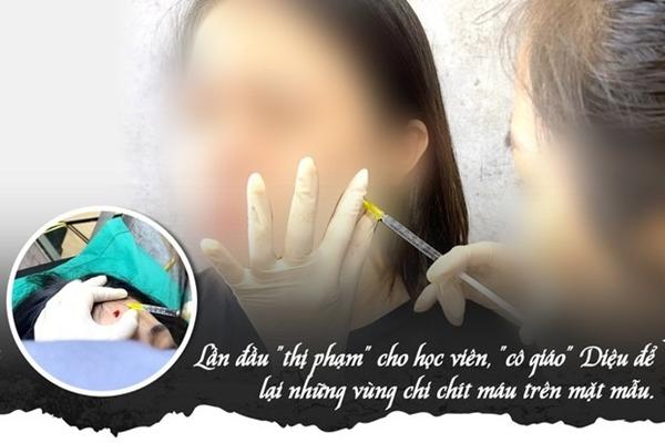 ‘Bác sĩ rởm’ tiêm filler chui: Hậu quả khủng khiếp, không thể cứu vãn-4