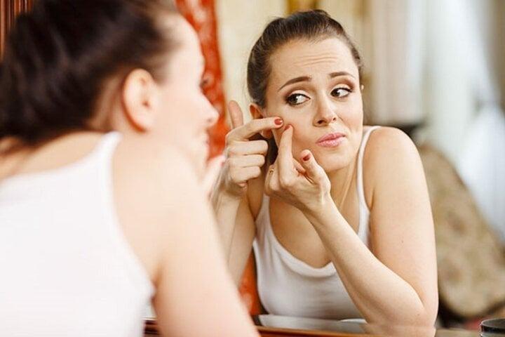 Vì sao mặt tự nhiên nổi nhiều mụn trứng cá?-3