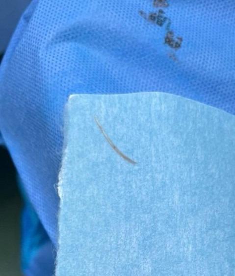 Buồng trứng phình to, nguy kịch vì thói quen phổ biến trong bữa ăn-1