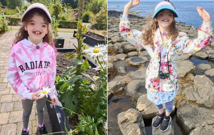 Cuộc sống hiện tại của cô bé không có mũi, phải thở bằng miệng-2