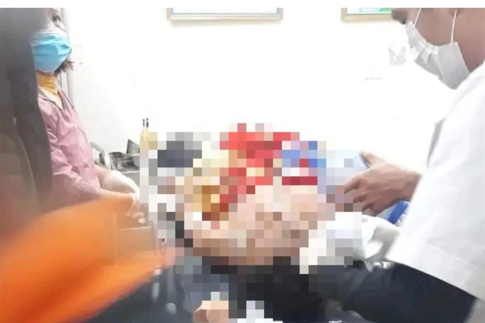 Nam thanh niên đến nhà đâm chết bạn do mâu thuẫn ở đám cưới-1