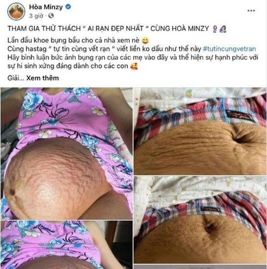 Lý do mỹ nhân Việt sẵn sàng vén áo, khoe bụng rạn chằng chịt-2