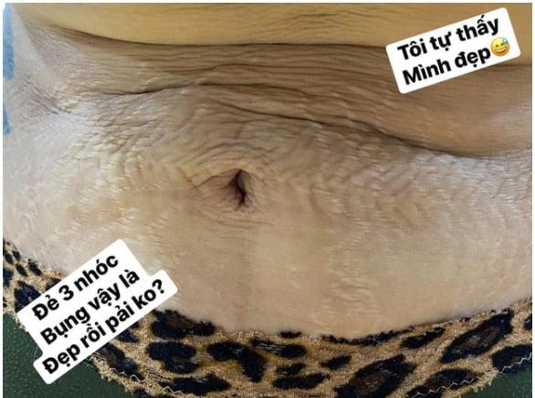 Lý do mỹ nhân Việt sẵn sàng vén áo, khoe bụng rạn chằng chịt-7