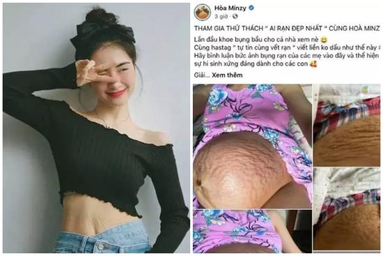 Lý do mỹ nhân Việt sẵn sàng vén áo, khoe bụng rạn chằng chịt