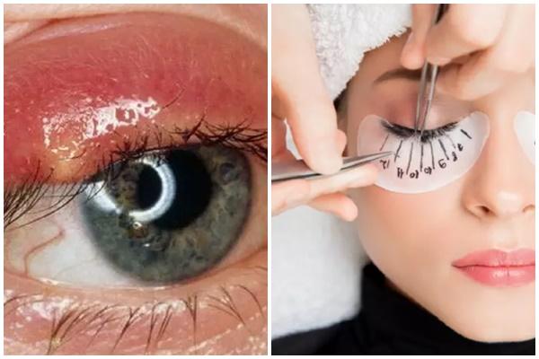 Những điều cần lưu ý khi nối mi-3