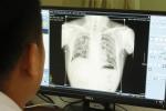 Sở Y tế Nghệ An lên tiếng về vụ nhiều công nhân mắc bệnh bụi phổi-3