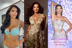 Thí sinh hiếm hoi chưa thẩm mỹ tại Hoa hậu Venezuela 2023