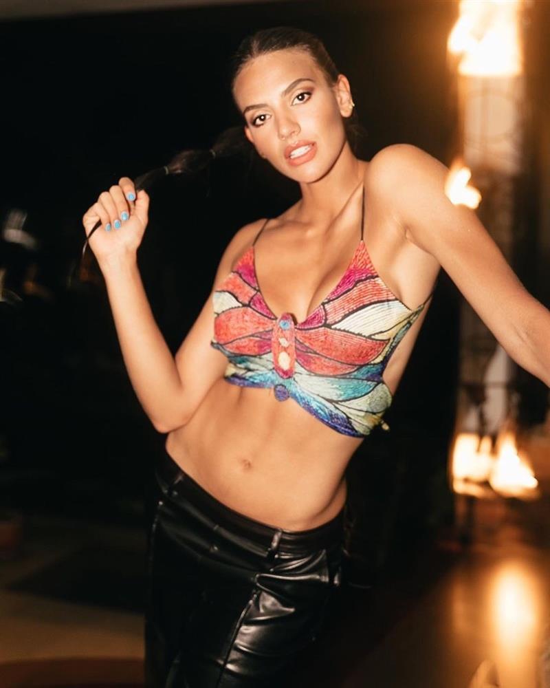 Thí sinh hiếm hoi chưa thẩm mỹ tại Hoa hậu Venezuela 2023-12