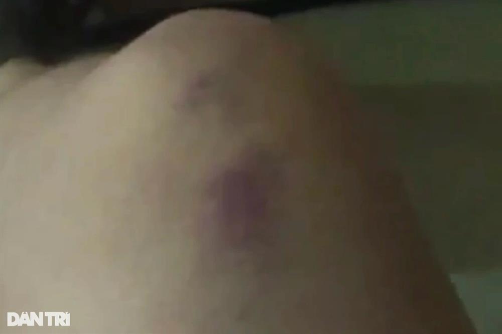 Cô giáo bị học sinh ném dép: Tôi trầm cảm, mất ăn mất ngủ-4