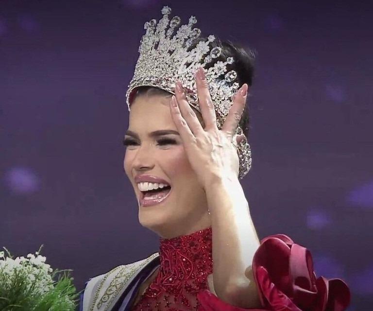 Người đẹp cực sexy có con năm 16 tuổi đoạt Hoa hậu Venezuela 2023-1