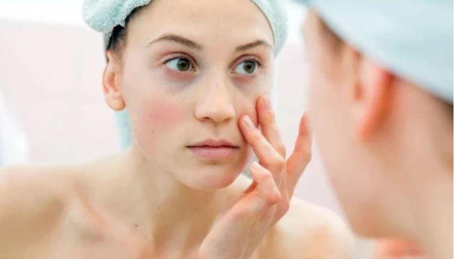 Quầng thâm mắt không chỉ do thiếu ngủ mà còn cảnh báo bệnh nguy hiểm-2