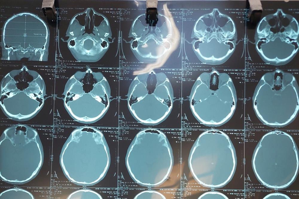 Cấp cứu 4 người bị tủ hồ sơ ngã đè tại tòa nhà trung tâm TPHCM-1