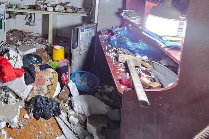 Bé trai 12 tuổi dập nát 2 bàn tay, mờ mắt do pháo nổ-2