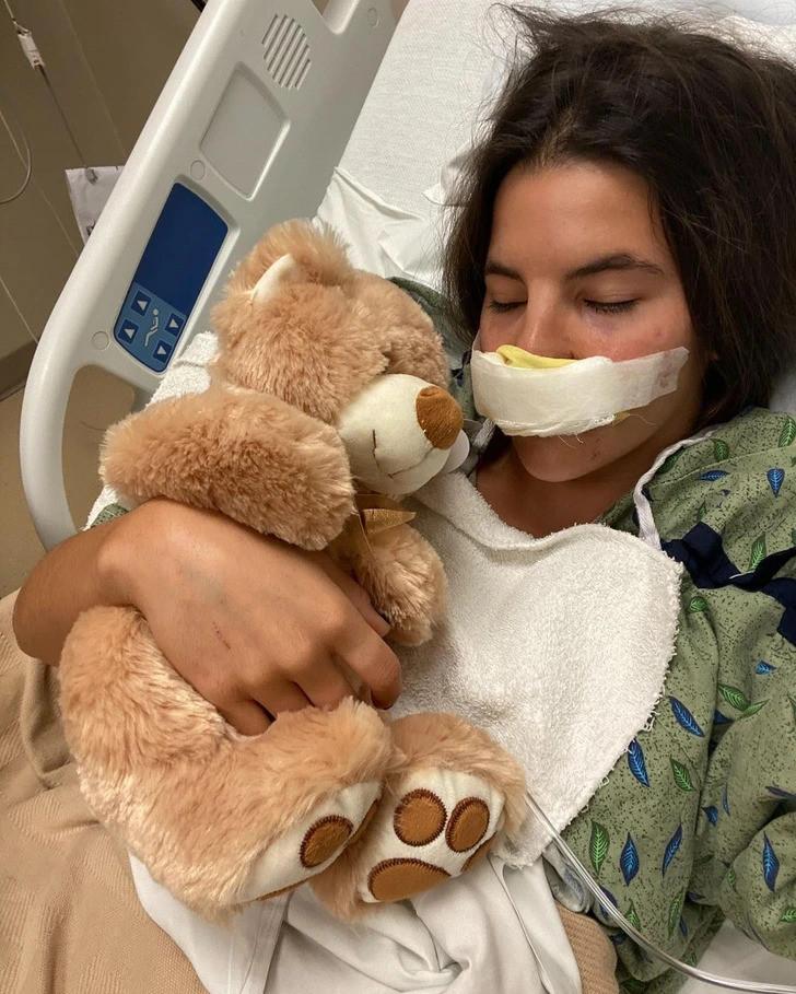 Khởi đầu một hành trình dài của cô gái bị chó Pitbull cắn mất môi trên-1