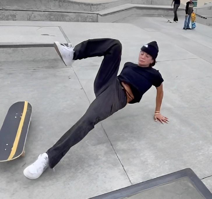 Khởi đầu một hành trình dài của cô gái bị chó Pitbull cắn mất môi trên-3