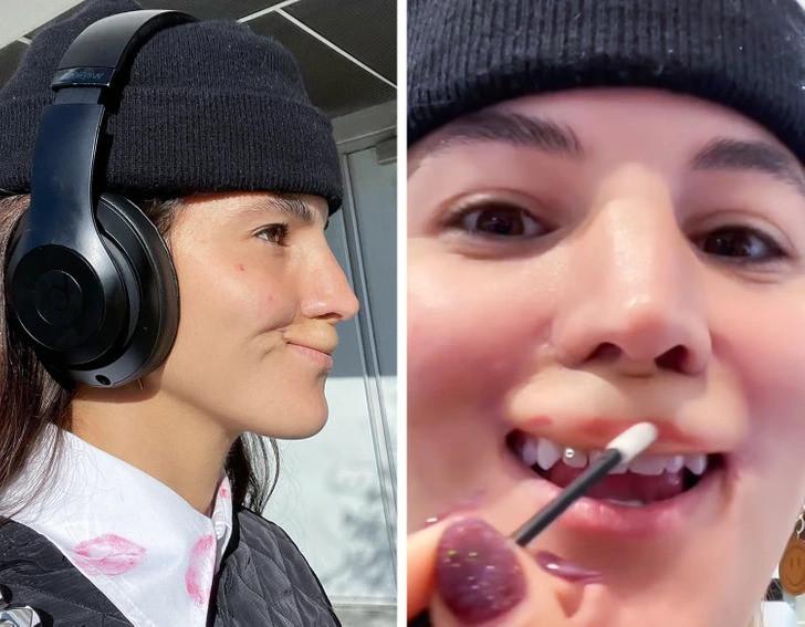 Khởi đầu một hành trình dài của cô gái bị chó Pitbull cắn mất môi trên-4