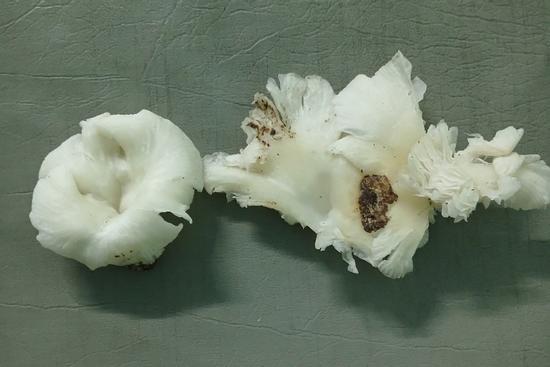 Ba người lên cơn co giật sau khi ăn nấm lạ