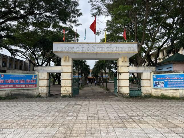 Vụ nam sinh lớp 9 bị bố bạn đánh: Tổn thương nội sọ, chấn thương quai hàm-2