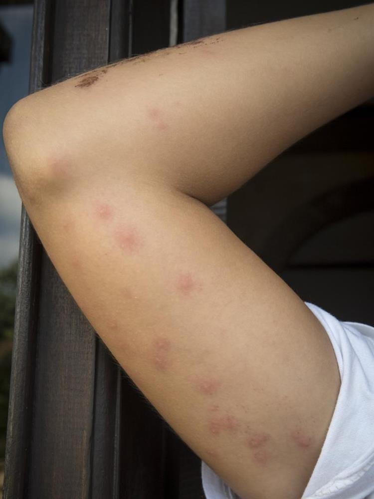 Phát hiện thứ kinh khủng trên giường khách sạn,du khách vội vã bỏ chạy-3