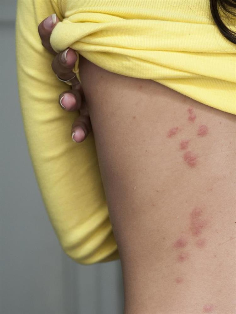 Phát hiện thứ kinh khủng trên giường khách sạn,du khách vội vã bỏ chạy-4