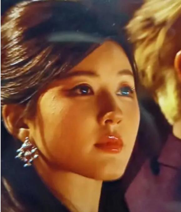 Triệu Lộ Tư xuất hiện nhiều nốt dị ứng trên mặt, lý do từ căn bệnh khiến cân nặng tăng vùn vụt-1