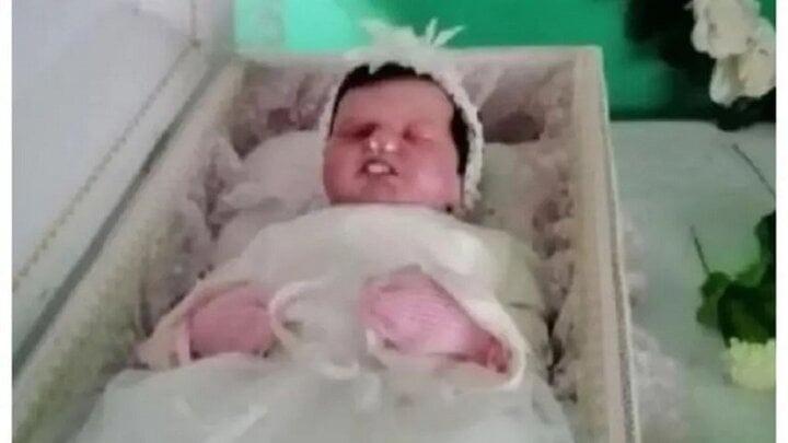 Bệnh viện trả thi thể em bé, gia đình phẫn nộ khi thấy hình nộm trong quan tài-1