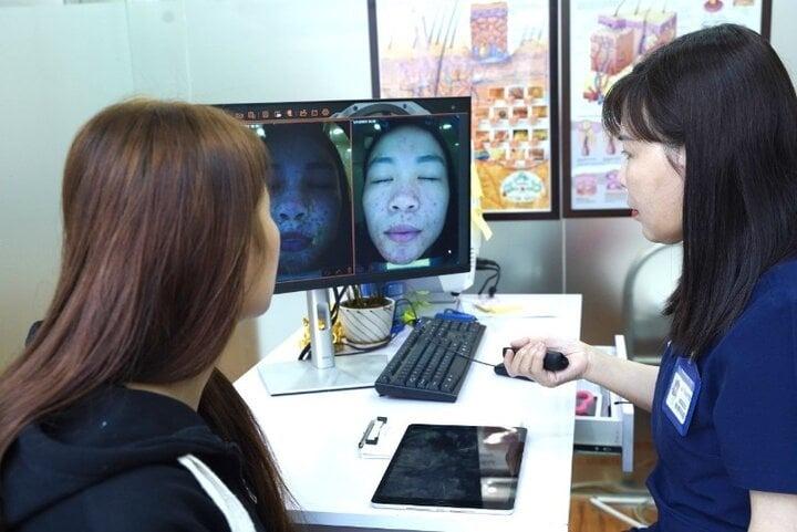 Dùng mỹ phẩm không rõ nguồn gốc, nhiều bạn trẻ bị nát mặt-2